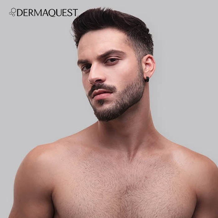 Dermaquest Acne Control