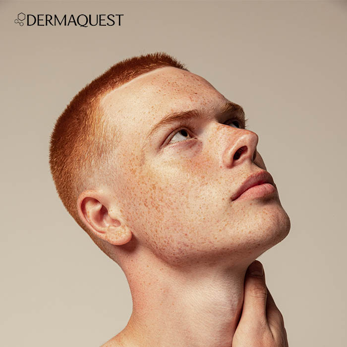 Dermaquest