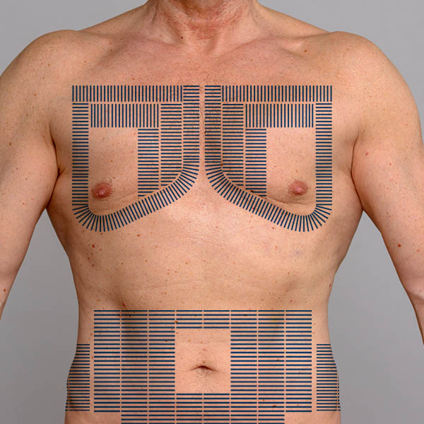 Abdomen, Flanks & Chest