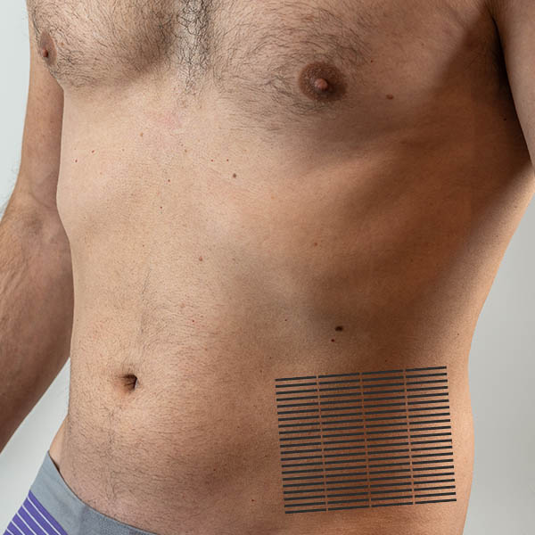 Abdomen & Flanks
