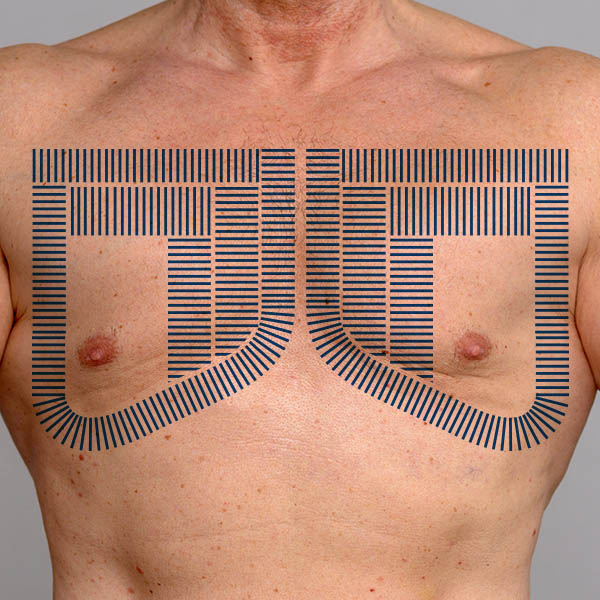 Chest