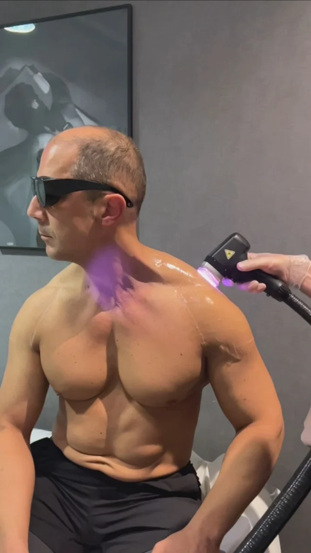 3 reasons why you should choose Mansculpt London for Laser Hair Removal 😎⚡️

#laserhairremoval #holborn #clinic #men #aesthetics #menstreatment #laserhairremovaltreatment #laserhair #menslaserhairremoval #sopranotitanium